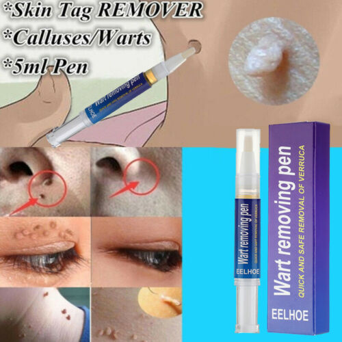 Warts Remover Original Cream Wart Removal