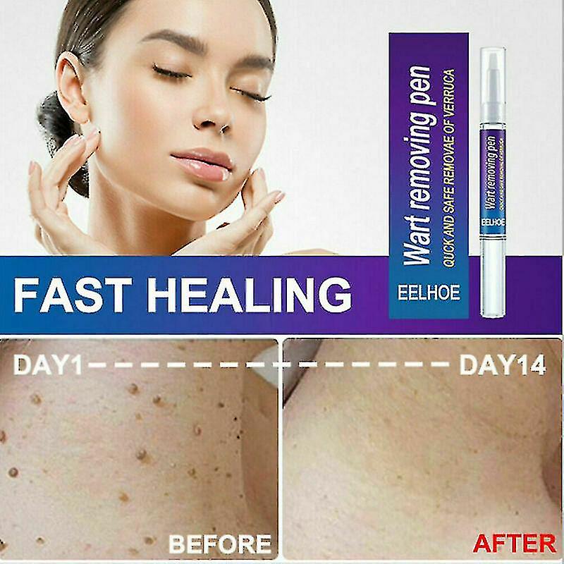 Warts Remover Original Cream Wart Removal