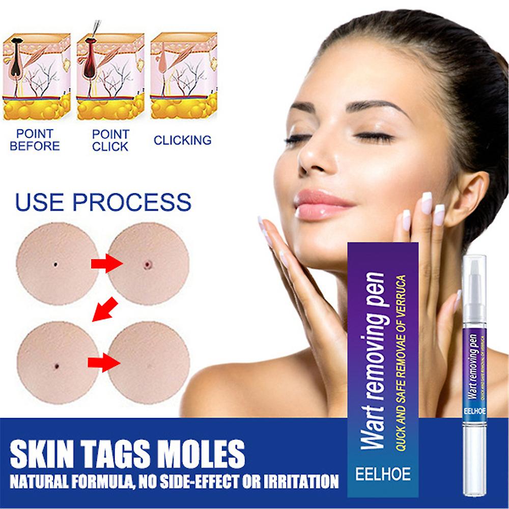 Warts Remover Original Cream Wart Removal