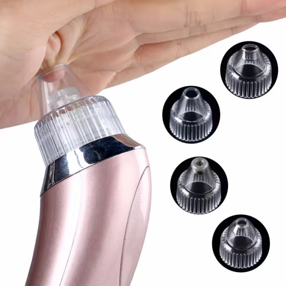 Electric Blackhead Acne Oil Remover
